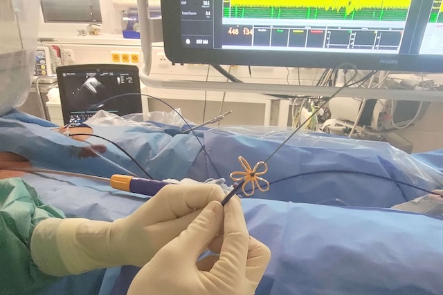 Čeští vědci vyvinuli AI nástroj, který může pomáhat v léčbě srdečních onemocnění